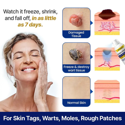 Prime® ChillErase Bump Renewal Spray