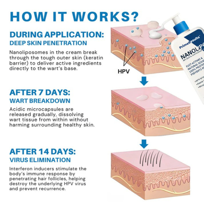 Prime® NanoLipo HPV Genital Warts Eraser Cream