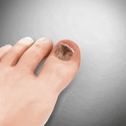 Prime™ FungiBee Advanced Nail Repair Spray