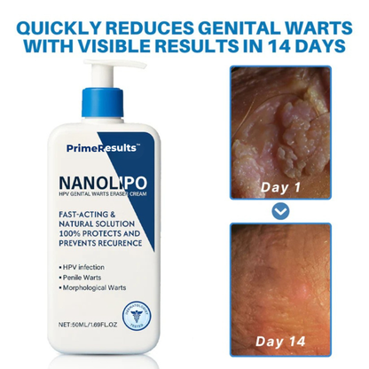 Prime® NanoLipo HPV Genital Warts Eraser Cream
