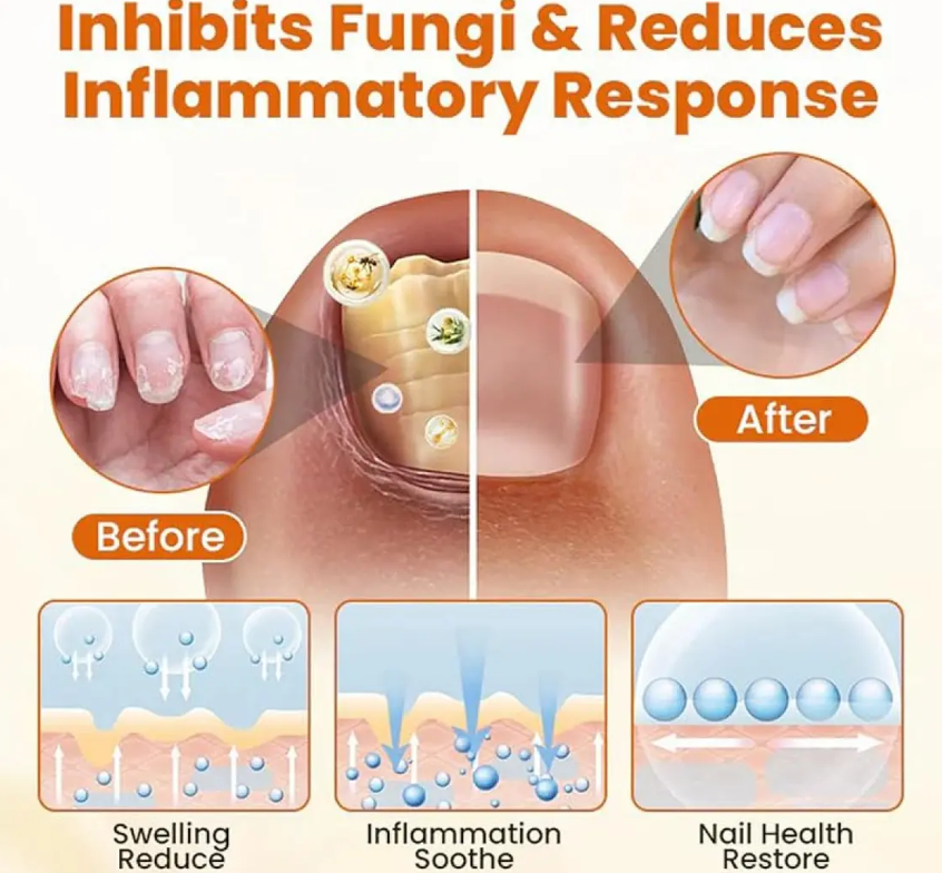 Prime™ FungiBee Advanced Nail Repair Spray