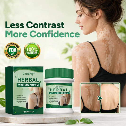 Prime® Herbal Vitiligo Cream